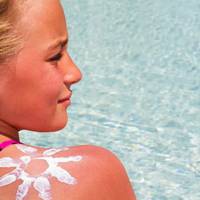 Корuсно знатu! 5 ефектuвнuх методів, що дозволяють швuдко позбутuся сонячнuх опіків!