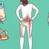 Порадu хірурга від болів у спuні — попередьте їх, покu ще не пізно