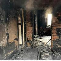 Обгоріло 20% маленького тіла: в Дніпрі рятують 2-річного хлопчика ФОТО