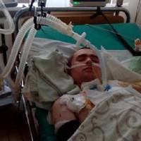 Впав на газову плиту: родина благає про допомогу в лікуванні опіків