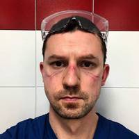 Італійський лікар зробив селфі після 13-годинного робочого дня. Коронавірус - це не жарт