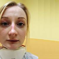 Лікарка з Чехії: Ми вже не можемо. Ми не спимо, не їмо.. Телефон дзвонить майже постійно. Люди, я прошу, перестаньте кричати на мене по телефону і особисто..