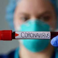 МОЗ повідомляє: Станом на 22:00 18 березня в Україні зафіксовано 16 випадків COVID-19: Чернівецька (10), Житомирська (1), Київська (2), Донецька (1) області та м. Київ (2).