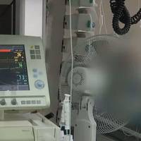 В екс-очільника СБУ підтверджено діагноз коронавірус. Його підключено до апарату ШВЛ..