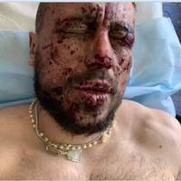 Наші захисники потрапили в бiдy ! У Крави залишилась мати, він був єдиним годувальником у родині.