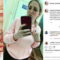 Лікарі замочують медичні маски та халати в хлорці, бо нових не має. Як наслідки – опіки