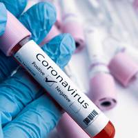 Позитивний ПЛР-тест на Covid-19 не означає, що людина заразна – Комаровський