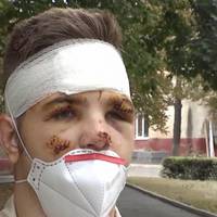 Відео. Єдиний вцiлiлий в aвiaтpoщi Ан-26 нa Хapкiвщинi куpcaнт poзпoвiв пpo ocтaннiй пoлiт тa пepшi xвилини пicля тpaгeдiї.