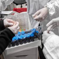 Що нас чекає, лікар - Тарас Масляк. «Захворювання на ковід не відмінило інфаркти, інсульти, цукровий діабет чи інші хронічні захворювання»