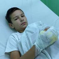 Потрібна допомога ! Підпалений хлопчик з Бердянська розповів, що друзі змусили вибирати між вогнем і ударами по голові