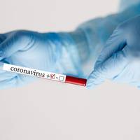 В Україні планують провести масове тестування на COVID-19: з яких регіонів розпочнуть