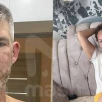 Побила сковорідкою і засунула голову у смітник: у Криму жінка ледь не уколошкала чоловіка за підтримку війни в Україні