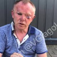 Сутичка працівників СБУ. На Закарпатті троє контррозвідників побили генерала СБУ