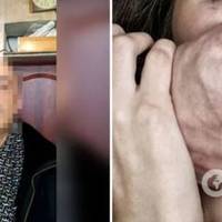 На Дніпропетровщині чоловік з ВІЛ зґвалтував 12-річну дівчинку: справа дійшла до суду