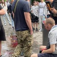 У самому центрі міста чоловіку зламали ніс за образу ЗСУ (ФОТО, ВІДЕО)