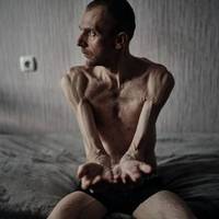 “Втратили по 40 кг ваги”: фотографи показали знімки українських військових після полону