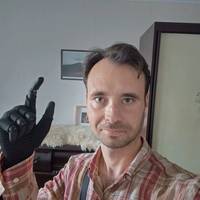 “З біонічним протезом почуваюсь більш цілісним”: воїн ЗСУ Аркатов про відновлення після важкого поранення
