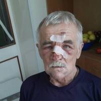Невідомий побив батька воїна ЗСУ, поки той був на фронті: у поліції намагаються 