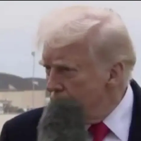 Трамп отримав мікрофоном по обличчю