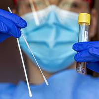 Лідерами з поширення Covid-19 стали Львівщина, Рівненщина та Закарпаття